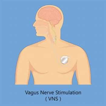 vns 300x300 1