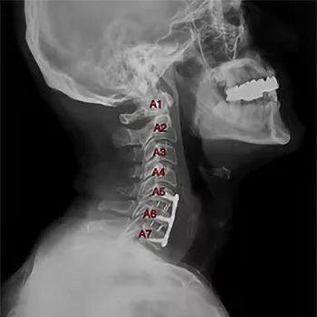 amss PROFIL Α5 Α6 Α7