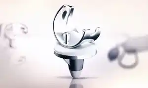 Εξατομικευμένη Αρθροπλαστική Γόνατος
